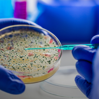 petri dish